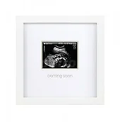 Ramki na zdjęcia - Pearhead ramka na zdjęcie USG Sonogram - miniaturka - grafika 1